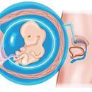 Hamilelikte 8. hafta